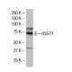 HSGT1 Antibody (RZ-17) - Western Blotting - Image 33507 