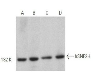 western blotting image from recommended hSNF2H (D-10) monoclonal antibody replacement. Image 358994