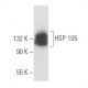 western blotting image from recommended HSP 105 (B-7) monoclonal antibody replacement. Image 356135