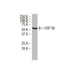 HSP 56 Antibody (329.1) - Western Blotting - Image 34133The Double Nickase Plasmid features a U6 promoter for sgRNA expression, a 20 nt targeting sequence, and a gRNA scaffold to guide Cas9n. It includes a CBh promoter for Cas9n (D10A) and puromycin resistance, GFP for transfection verification, and nuclear localization signals (NLS). The 2A peptide allows co-expression of Cas9n and Puro from a single promoter, enabling precise genome editing with reduced off-target effects.