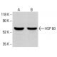 HSP 60 Antibody (24) - Western Blotting - Image 413462