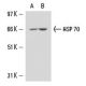 HSP70 Antibody (4E7) - Western Blotting - Image 15741