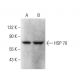 HSP 70 Antibody (6D444) - Western Blotting - Image 377692 