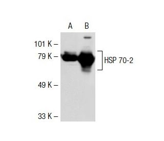 HSP 70 (W27): sc-24. Western blot analysis of HSP 70... 