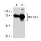 HSP 70 (W27): sc-24. Western blot analysis of HSP 70... 