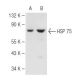 HSP 75 Antibody (42) - Western Blotting - Image 84117 
