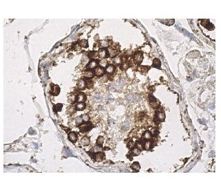 https://media.scbt.com/product/hsp-90alpha-beta-antibody-f-8-immunohistochemistry_15_65_b_156510.jpg