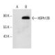 HSPA12B Antibody (A-12) - Western Blotting - Image 151730