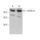 HSPA14 Antibody (G-9) - Western Blotting - Image 372911 