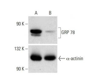 GRP 78 CRISPR/CAS9 KO Plasmid (h): sc-400073. Western blot analysis of GRP 78 expression in empty vector control (A) and GEach CRISPR/Cas9 Knockout (KO) Plasmid product consists of a pool of 3 plasmids designed to ensure identification and cleavage of a specific gene for maximum knockout efficiency. Each plasmid encodes a unique 20 nt sequence derived from the GeCKO (v2) library.