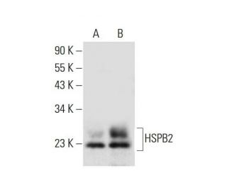 HSPB2 Antibody (F-9) - Western Blotting - Image 317946 