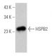 HSPB2 Antibody (F-9) - Western Blotting - Image 365972
