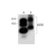 HSPB7 Antibody (F-4) - Western Blotting - Image 297946