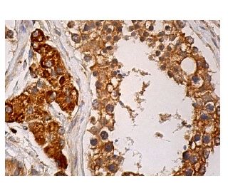 HSPBAP1 Antibody (B-1): sc-374290