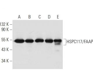 HSPC117/FAAP Antibody (C-3) - Western Blotting - Image 299436 