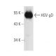 HSV-1 gD Antibody (DL6) - Western Blotting - Image 6518