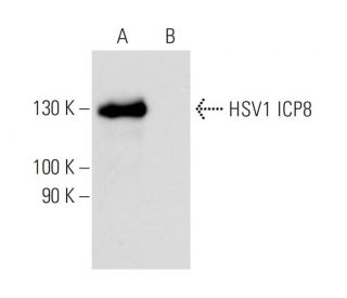 HSV-1 ICP8 Antibody (10A3) - Western Blotting - Image 12970
