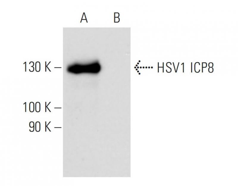 HSV 1 ICP8 Antibody 10A3 SCBT Santa Cruz Biotechnology