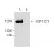HSV-1 ICP8 Antibody (10A3) - Western Blotting - Image 12970