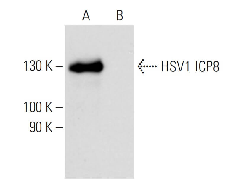waiting on hsv western blot results med help