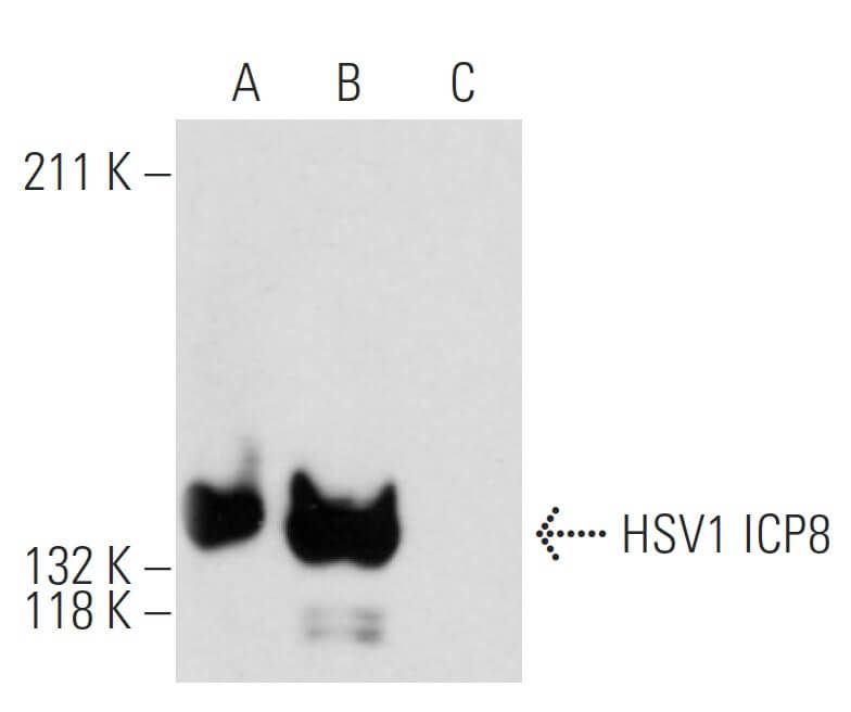HSV1 ICP8 Antibody (11E2) SCBT Santa Cruz Biotechnology