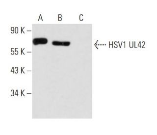 HSV-1 UL42 Antibody (13C9) - Western Blotting - Image 13578 