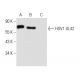 HSV-1 UL42 Antibody (13C9) - Western Blotting - Image 13578 