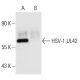 HSV-1 UL42 Antibody (13D11) - Western Blotting - Image 14092