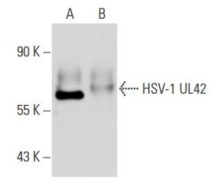 HSV-1 UL42 Antibody (2H4) - Western Blotting - Image 14090