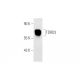 HT-1080 Whole Cell Lysate: sc-364183. Western blot analysis of TDRD3...