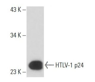 HTLV-1 p24 Antibody (46/3.24.4) - Western Blotting - Image 16370