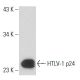 HTLV-1 p24 Antibody (46/3.24.4) - Western Blotting - Image 16370