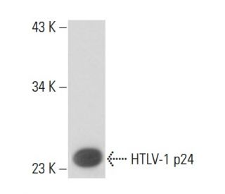 HTLV-1 p24 Antibody (6G9) - Western Blotting - Image 16371
