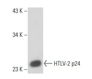 HTLV-2 p24 Antibody (75/4.21.11) - Western Blotting - Image 16372