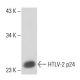 HTLV-2 p24 Antibody (75/4.21.11) - Western Blotting - Image 16372
