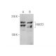 HUGT2 Antibody (G-7) - Western Blotting - Image 351670 