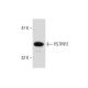 human platelet extract: sc-363773. Western blot analysis of PSTPIP2 expression... 