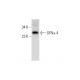 human thyroid extract: sc-363782. Western blot analysis of GFR alpha-4 expression... 
