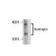 Huntingtin Antibody (HDC8A4) - Western Blotting - Image 17782 