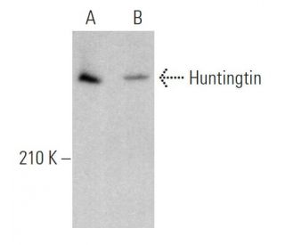 Huntingtin Antibody (3E10) - Western Blotting - Image 362887The Double Nickase Plasmid features a U6 promoter for sgRNA expression, a 20 nt targeting sequence, and a gRNA scaffold to guide Cas9n. It includes a CBh promoter for Cas9n (D10A) and puromycin resistance, GFP for transfection verification, and nuclear localization signals (NLS). The 2A peptide allows co-expression of Cas9n and Puro from a single promoter, enabling precise genome editing with reduced off-target effects. 