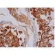 HURP Antibody (E-7) - Immunohistochemistry - Image 286495 