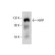 HURP Antibody (E-7) - Western Blotting - Image 260699