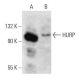 HURP Antibody (E-7) - Western Blotting - Image 358631 