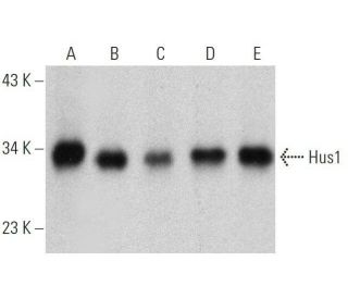 western blotting image from recommended Hus1 (G-3) monoclonal antibody replacement. Image 359396