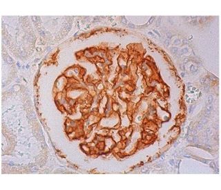 HVEM Antibody (122) - Immunohistochemistry - Image 295217