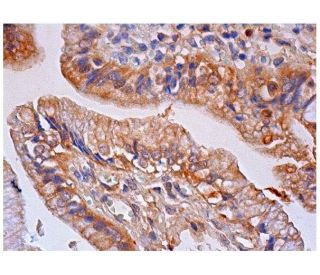 HVEM Antibody (CW10) - Immunohistochemistry - Image 284767 