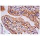 HVEM Antibody (CW10) - Immunohistochemistry - Image 284767 