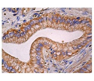 HVEM Antibody (D-5) - Immunohistochemistry - Image 260800 