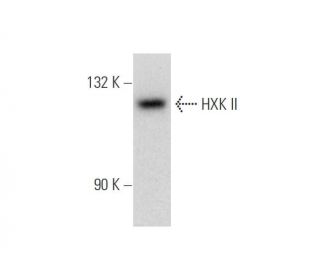 HXK II Antibody (1A7) - Western Blotting - Image 65669 