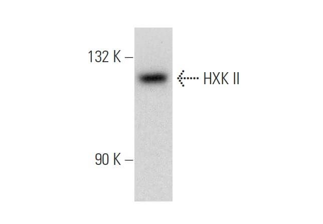 HXK II Antibody (1A7) | SCBT - Santa Cruz Biotechnology